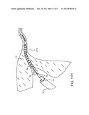 DEPLOYMENT ACTUATION SYSTEM diagram and image