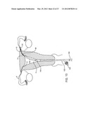 DEPLOYMENT ACTUATION SYSTEM diagram and image