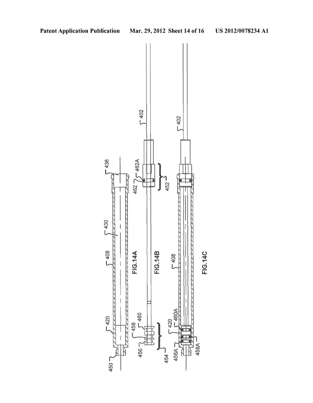 POWER ASSISTED LIPOPLASTY - diagram, schematic, and image 15