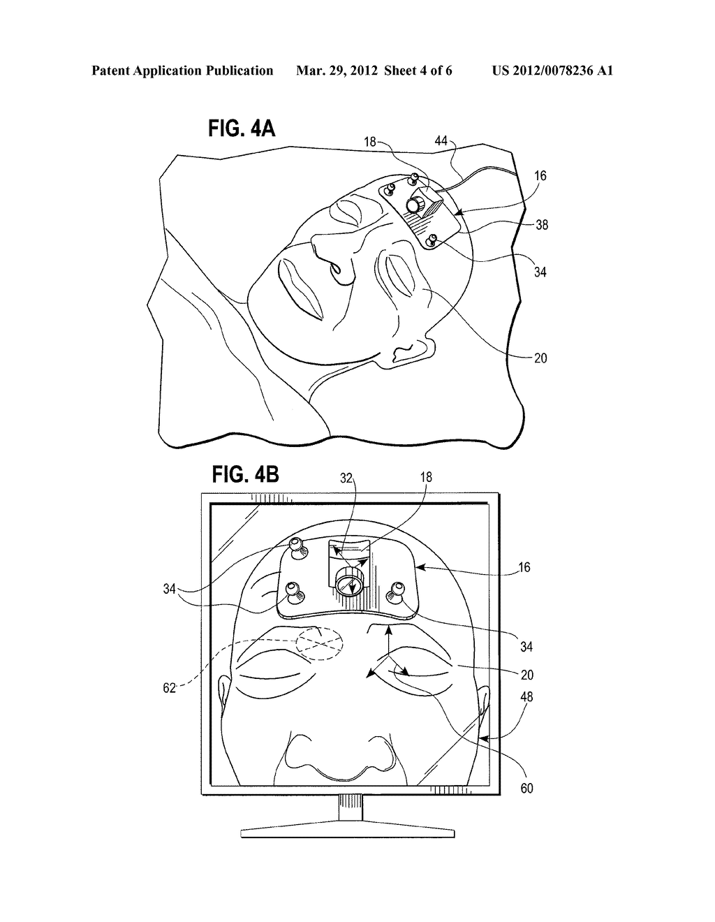 Surgical Navigation System - diagram, schematic, and image 05