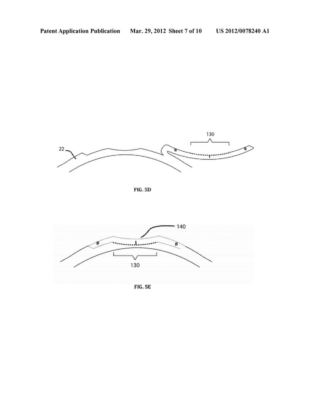 LASER APPARATUS AND METHOD FOR REFRACTIVE SURGERY - diagram, schematic, and image 08