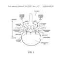 Mechanical tissue modification devices and methods diagram and image