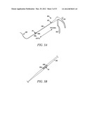 Mechanical tissue modification devices and methods diagram and image