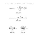 Mechanical tissue modification devices and methods diagram and image