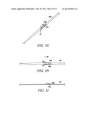 Mechanical tissue modification devices and methods diagram and image