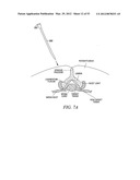 Mechanical tissue modification devices and methods diagram and image