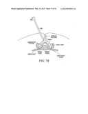 Mechanical tissue modification devices and methods diagram and image