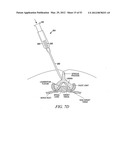 Mechanical tissue modification devices and methods diagram and image