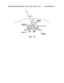 Mechanical tissue modification devices and methods diagram and image