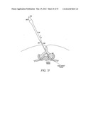 Mechanical tissue modification devices and methods diagram and image