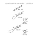 Mechanical tissue modification devices and methods diagram and image