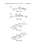 Mechanical tissue modification devices and methods diagram and image