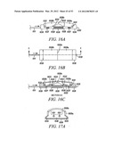 Mechanical tissue modification devices and methods diagram and image