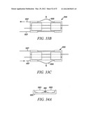 Mechanical tissue modification devices and methods diagram and image