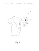 CUSTOMIZED PATIENT-SPECIFIC COMPUTER CONTROLLED CUTTING SYSTEM AND METHOD diagram and image