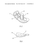 METHOD OF ARTHROPLASTY ON A KNEE JOINT AND APPARATUS FOR USE IN SAME diagram and image