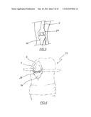 METHOD OF ARTHROPLASTY ON A KNEE JOINT AND APPARATUS FOR USE IN SAME diagram and image