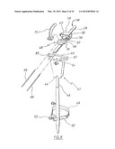 METHOD OF ARTHROPLASTY ON A KNEE JOINT AND APPARATUS FOR USE IN SAME diagram and image