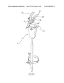 METHOD OF ARTHROPLASTY ON A KNEE JOINT AND APPARATUS FOR USE IN SAME diagram and image