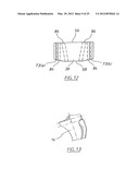 METHOD OF ARTHROPLASTY ON A KNEE JOINT AND APPARATUS FOR USE IN SAME diagram and image