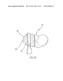 METHOD OF ARTHROPLASTY ON A KNEE JOINT AND APPARATUS FOR USE IN SAME diagram and image