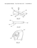 METHOD OF ARTHROPLASTY ON A KNEE JOINT AND APPARATUS FOR USE IN SAME diagram and image