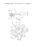 METHOD OF ARTHROPLASTY ON A KNEE JOINT AND APPARATUS FOR USE IN SAME diagram and image