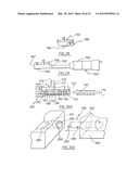 METHOD OF ARTHROPLASTY ON A KNEE JOINT AND APPARATUS FOR USE IN SAME diagram and image