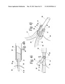 SURGICAL TISSUE RETRIEVAL INSTRUMENT AND METHOD OF USE OF A SURGICAL     TISSUE RETRIEVAL INSTRUMENT diagram and image