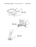 APPARATUSES AND METHODS FOR FORMING INCISIONS IN OCULAR TISSUE diagram and image