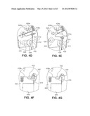 APPARATUSES AND METHODS FOR FORMING INCISIONS IN OCULAR TISSUE diagram and image