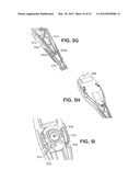 APPARATUSES AND METHODS FOR FORMING INCISIONS IN OCULAR TISSUE diagram and image