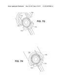 APPARATUSES AND METHODS FOR FORMING INCISIONS IN OCULAR TISSUE diagram and image