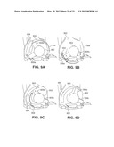 APPARATUSES AND METHODS FOR FORMING INCISIONS IN OCULAR TISSUE diagram and image