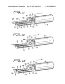 Vascular Hole Closure Delivery Device diagram and image