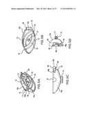 INTERSPINOUS IMPLANTS AND METHODS FOR IMPLANTING SAME diagram and image