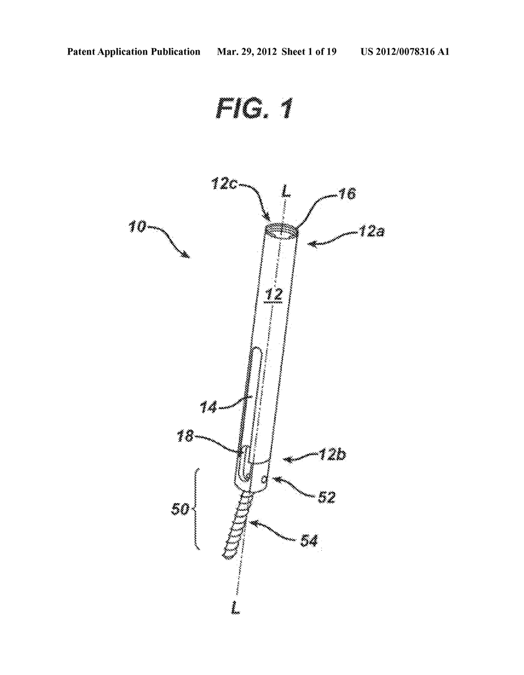 Methods and Devices for Minimally Invasive Spinal Fixation Element     Placement - diagram, schematic, and image 02