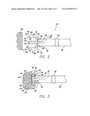 METHOD FOR INDICATING EMBEDMENT OF A HELICAL ANCHOR IN CARDIAC TISSUE VIA     FLUOROSCOPY diagram and image