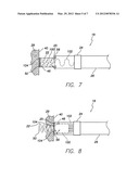 METHOD FOR INDICATING EMBEDMENT OF A HELICAL ANCHOR IN CARDIAC TISSUE VIA     FLUOROSCOPY diagram and image