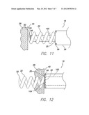 METHOD FOR INDICATING EMBEDMENT OF A HELICAL ANCHOR IN CARDIAC TISSUE VIA     FLUOROSCOPY diagram and image