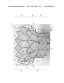 REPLACEMENT HEART VALVES, DELIVERY DEVICES AND METHODS diagram and image