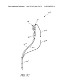 REPLACEMENT HEART VALVES, DELIVERY DEVICES AND METHODS diagram and image