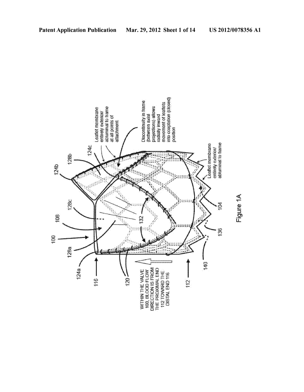 PERCUTANEOUSLY DELIVERABLE HEART OR BLOOD VESSEL VALVE WITH FRAME HAVING     ABLUMINALLY SITUATED TISSUE MEMBRANE - diagram, schematic, and image 02