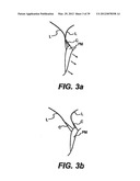 Devices and Methods for Heart Valve Treatment diagram and image