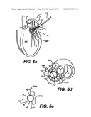 Devices and Methods for Heart Valve Treatment diagram and image