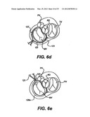 Devices and Methods for Heart Valve Treatment diagram and image