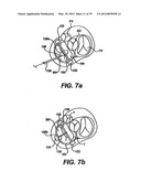 Devices and Methods for Heart Valve Treatment diagram and image