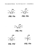 Devices and Methods for Heart Valve Treatment diagram and image