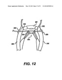 Devices and Methods for Heart Valve Treatment diagram and image