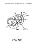 Devices and Methods for Heart Valve Treatment diagram and image